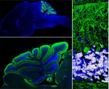 itano-Lorenzo-lab-targeting-cerebelar-neurons